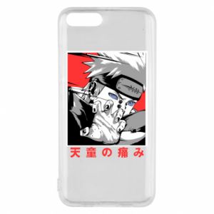 Xiaomi Mi-6